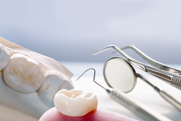 The Benefits Of Dental Crowns For Your Oral Health