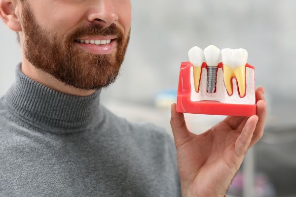 Missing A Single Tooth? Consider A Dental Implant