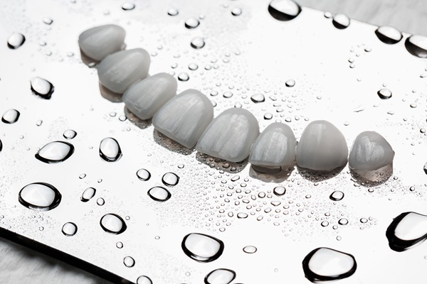 The Importance Of Choosing A Dental Professional For Dental Veneers