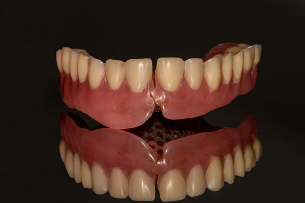 Signs That You Might Need Denture Repair