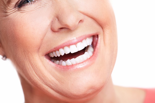 What Is Full Mouth Reconstruction?