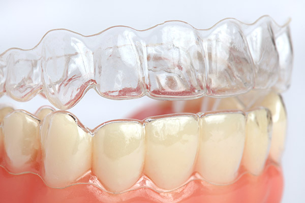 Your Golden Years Are An Excellent Time For Invisalign®