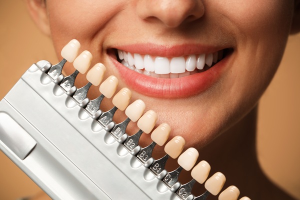 Benefits Of Porcelain Veneers