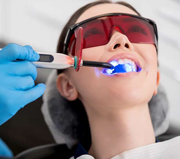 Irvine Professional Teeth Whitening