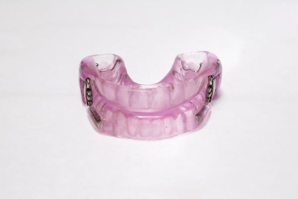 Treating Sleep Apnea With A Dental Oral Appliance